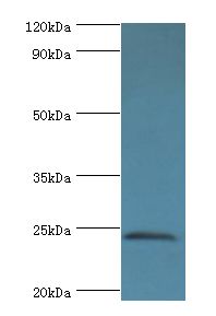 SOST / Sclerostin Antibody - Western blot. All lanes: SOST antibody at 4 ug/ml+HeLa whole cell lysate. Secondary antibody: Goat polyclonal to rabbit at 1:10000 dilution. Predicted band size: 24 kDa. Observed band size: 24 kDa.
