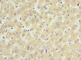 SOST / Sclerostin Antibody - Immunohistochemistry of paraffin-embedded human liver tissue using SOST Antibody at dilution of 1:100