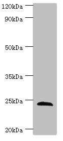 SOST / Sclerostin Antibody - Western blot All lanes: SOST antibody at 4µg/ml + Hela whole cell lysate Secondary Goat polyclonal to rabbit IgG at 1/10000 dilution Predicted band size: 24 kDa Observed band size: 24 kDa