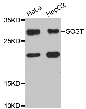 SOST / Sclerostin Antibody - Western blot analysis of extracts of various cell lines.