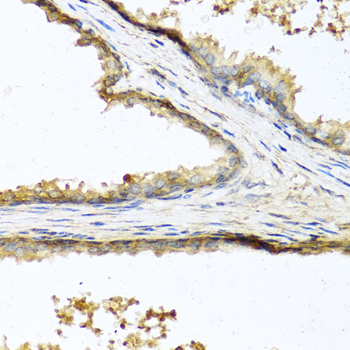 SOST / Sclerostin Antibody - Immunohistochemistry of paraffin-embedded human prostate.