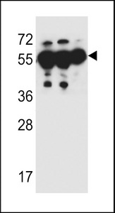 SOWAHC / ANKRD57 Antibody - ANKRD57 Antibody western blot of MDA-MB231,HepG2,A549 cell line lysates (35 ug/lane). The ANKRD57 antibody detected the ANKRD57 protein (arrow).