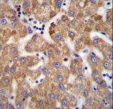 SOWAHD / ANKRD58 Antibody - ANKRD58 Antibody immunohistochemistry of formalin-fixed and paraffin-embedded human liver tissue followed by peroxidase-conjugated secondary antibody and DAB staining.