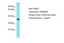 SOWAHD / ANKRD58 Antibody -  This image was taken for the unconjugated form of this product. Other forms have not been tested.