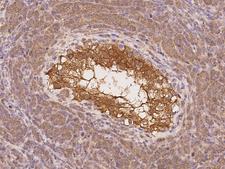 SOWAHD / ANKRD58 Antibody - Immunochemical staining of human SOWAHD in human testis with rabbit polyclonal antibody at 1:100 dilution, formalin-fixed paraffin embedded sections.