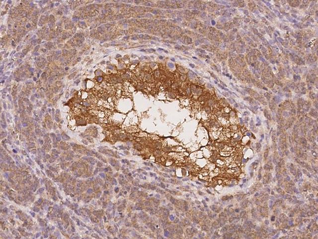 SOWAHD / ANKRD58 Antibody - Immunochemical staining of human SOWAHD in human testis with rabbit polyclonal antibody at 1:100 dilution, formalin-fixed paraffin embedded sections.