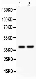 SOX1 Antibody - SOX1 antibody Western blot. All lanes: Anti SOX1 at 0.5 ug/ml. Lane 1: Rat Brain Tissue Lysate at 50 ug. Lane 2: NIH3T3 Whole Cell Lysate at 40 ug. Predicted band size: 39 kD. Observed band size: 39 kD.