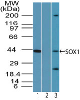 SOX1 Antibody - Western blot of SOX1 in human brain lysate in the 1) absence and 2) presence of immunizing peptide and 3) mouse brain lysate using Peptide-affinity Purified Polyclonal Antibody to SOX1 at 0.5 ug/ml, 0.5 ug/ml and2 ug/ml respectively. Goat anti-rabbit Ig HRP secondary antibody, and PicoTect ECL substrate solution, were used for this test.