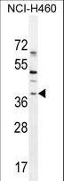 SOX1 Antibody - SOX1 Antibody western blot of NCI-H460 cell line lysates (35 ug/lane). The SOX1 antibody detected the SOX1 protein (arrow).