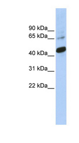 SOX1 Antibody - SOX1 antibody Western blot of Jurkat lysate. This image was taken for the unconjugated form of this product. Other forms have not been tested.