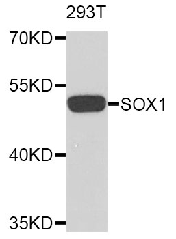 SOX1 Antibody - Western blot analysis of extracts of 293T cells.