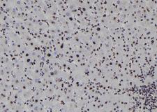 SOX1 Antibody - 1:100 staining human liver tissue by IHC-P. The sample was formaldehyde fixed and a heat mediated antigen retrieval step in citrate buffer was performed. The sample was then blocked and incubated with the antibody for 1.5 hours at 22°C. An HRP conjugated goat anti-rabbit antibody was used as the secondary.