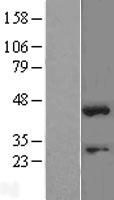 SOX1 Protein - Western validation with an anti-DDK antibody * L: Control HEK293 lysate R: Over-expression lysate