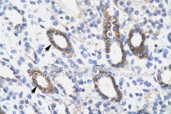 SOX10 Antibody - SOX10 antibody IHC of formalin-fixed, paraffin-embedded human Kidney. Positive label: Epithelial cells of renal tubule indicated with arrows. Antibody concentration 4-8 ug/ml. Magnification 400X. This image was taken for the unconjugated form of this product. Other forms have not been tested.