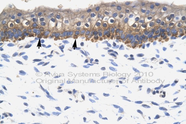 SOX10 Antibody - SOX10 antibody IHC of formalin-fixed, paraffin-embedded human Skin. Positive label: Epidermal cells indicated with arrows. Antibody concentration 4-8 ug/ml. Magnification 400X. This image was taken for the unconjugated form of this product. Other forms have not been tested.