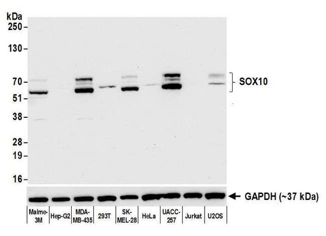 SOX10 Antibody - Detection of human SOX10 by western blot. Samples: Whole cell lysate (15 µg) from Malme-3M, Hep-G2, MDA-MB-435, HEK293T, SK-MEL-28, HeLa, UACC-257, Jurkat, and U2OS cells prepared using NETN lysis buffer. Antibody: Rabbit anti-SOX10 antibody used at 1:1000. Detection: Chemiluminescence with an exposure time of 10 seconds. Lower Panel: Rabbit anti-GAPDH (A300-639A).