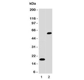 SOX10 Antibody - Western blot testing of 1) partial recombinant protein and 2) A375 cell lysate using SOX10 antibody. Predicted molecular weight ~50 kDa.