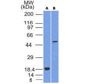 SOX10 Antibody - Western blot testing of A) partial recombinant protein; B) A375 cell lysate using SOX-10 antibody (SOX10/1074). Predicted molecular weight ~50 kDa.