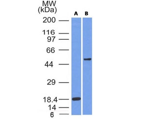 SOX10 Antibody - Western blot testing of A) partial recombinant protein B) A375 cell lysate using SOX10 antibody (SOX10/991). Predicted molecular weight ~50 kDa.
