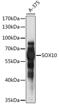 SOX10 Antibody - Western blot analysis of extracts of A-375 cells, using SOX10 antibody at 1:1000 dilution. The secondary antibody used was an HRP Goat Anti-Rabbit IgG (H+L) at 1:10000 dilution. Lysates were loaded 25ug per lane and 3% nonfat dry milk in TBST was used for blocking. An ECL Kit was used for detection and the exposure time was 30s.