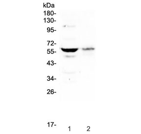 SOX10 Antibody - Western blot testing of human 1) U-87 MG and 2) A375 cell lyate with SOX10 antibody at 0.5ug/ml. Expected molecular weight: 50-58 kDa.