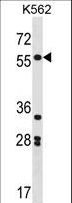 SOX11 Antibody - SOX11 Antibody western blot of K562 cell line lysates (35 ug/lane). The SOX11 antibody detected the SOX11 protein (arrow).