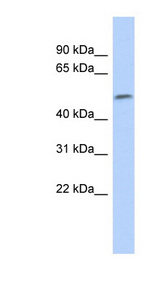 SOX11 Antibody - SOX11 antibody Western blot of Fetal Small Intestine lysate. This image was taken for the unconjugated form of this product. Other forms have not been tested.