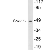 SOX11 Antibody - Western blot analysis of lysates from Y79 cells, using Sox-11 antibody.