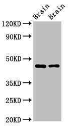 SOX11 Antibody - Positive Western Blot detected in Rat brain tissue, Mouse brain tissue. All lanes: SOX11 antibody at 2.7 µg/ml Secondary Goat polyclonal to rabbit IgG at 1/50000 dilution. Predicted band size: 47 KDa. Observed band size: 47 KDa
