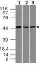 SOX11 Antibody - Fig-1: Western blot analysis of Sox11. Anti-Sox11 antibody was tested at 0.5 µg/ml on A431, human Kidney and Y79 lysates.