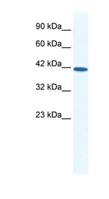 SOX11 Antibody - SOX11 antibody Western blot of HepG2 cell lysate. This image was taken for the unconjugated form of this product. Other forms have not been tested.