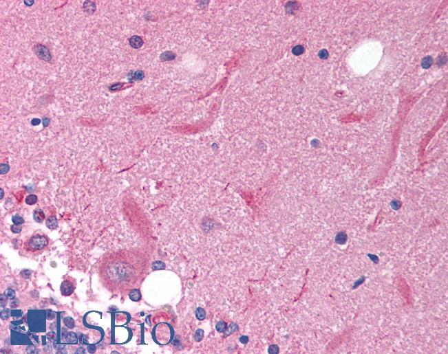 SOX11 Antibody - Anti-SOX11 antibody IHC of human brain, cerebellum. Immunohistochemistry of formalin-fixed, paraffin-embedded tissue after heat-induced antigen retrieval. Antibody concentration 5 ug/ml.  This image was taken for the unconjugated form of this product. Other forms have not been tested.
