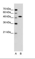SOX11 Antibody - A: Marker, B: Jurkat Cell Lysate.  This image was taken for the unconjugated form of this product. Other forms have not been tested.