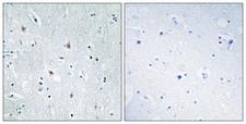 SOX12 Antibody - Immunohistochemistry analysis of paraffin-embedded human brain tissue, using SOX12 Antibody. The picture on the right is blocked with the synthesized peptide.