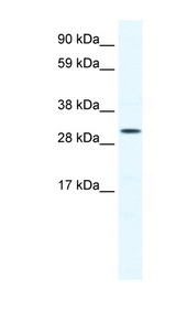 SOX12 Antibody - SOX12 antibody Western blot of Jurkat lysate. This image was taken for the unconjugated form of this product. Other forms have not been tested.