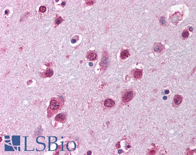 SOX12 Antibody - Anti-SOX12 antibody IHC of human brain, cortex. Immunohistochemistry of formalin-fixed, paraffin-embedded tissue after heat-induced antigen retrieval. Antibody concentration 5 ug/ml.  This image was taken for the unconjugated form of this product. Other forms have not been tested.
