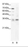 SOX12 Antibody - A: Marker, B: HepG2 Cell Lysate.  This image was taken for the unconjugated form of this product. Other forms have not been tested.