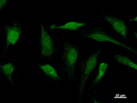 SOX12 Antibody - Immunostaining analysis in HeLa cells. HeLa cells were fixed with 4% paraformaldehyde and permeabilized with 0.1% Triton X-100 in PBS. The cells were immunostained with anti-SOX12 mAb.