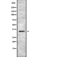 SOX12 Antibody - Western blot analysis SOX12 using COLO205 whole cells lysates