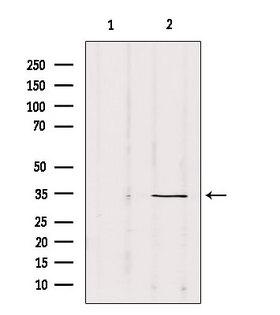 SOX12 Antibody - Western blot analysis of extracts of mouse Myeloma cells using SOX12 antibody. Lane 1 was treated with the blocking peptide.