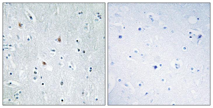 SOX12 Antibody - Peptide - + Immunohistochemistry analysis of paraffin-embedded human brain tissue, using SOX12 antibody.