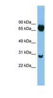 SOX13 Antibody - SOX13 antibody Western blot of ACHN lysate. This image was taken for the unconjugated form of this product. Other forms have not been tested.