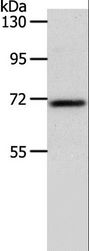 SOX13 Antibody - Western blot analysis of Mouse liver tissue, using SOX13 Polyclonal Antibody at dilution of 1:800.