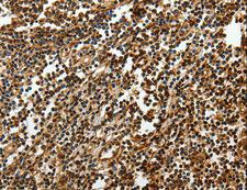 SOX13 Antibody - Immunohistochemistry of paraffin-embedded Human tonsil using SOX13 Polyclonal Antibody at dilution of 1:50.