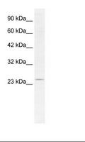 SOX14 Antibody - HepG2 Cell Lysate.  This image was taken for the unconjugated form of this product. Other forms have not been tested.