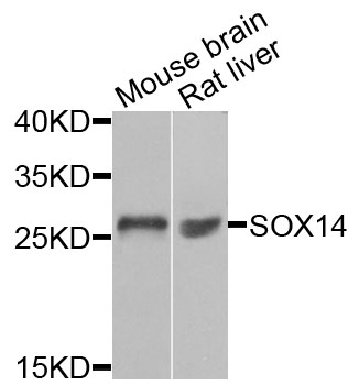SOX14 Antibody - Western blot analysis of extracts of various cells.