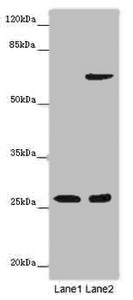 SOX14 Antibody - Western blot All Lanes: SOX14 antibody at 14 ug/ml Lane 1: Human placenta tissue Lane 2: HepG-2 whole cell lysate Secondary Goat polyclonal to rabbit IgG at 1/10000 dilution Predicted band size: 26 kDa Observed band size: 26,65 kDa