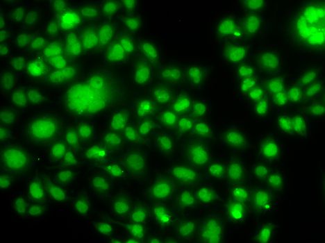 SOX14 Antibody - Immunofluorescence analysis of MCF-7 cells using SOX14 antibody.