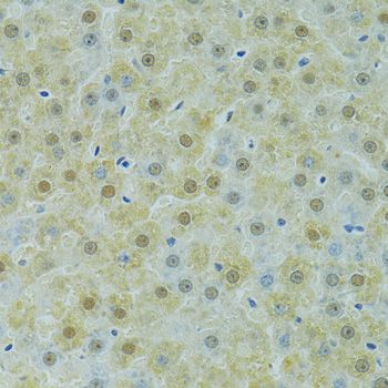 SOX14 Antibody - Immunohistochemistry of paraffin-embedded rat liver using SOX14 antibody at dilution of 1:100 (40x lens).