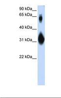 SOX15 Antibody - Transfected 293T cell lysate. Antibody concentration: 1.0 ug/ml. Gel concentration: 12%.  This image was taken for the unconjugated form of this product. Other forms have not been tested.